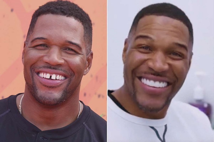 Don't do it': Michael Strahan fixes his trademark smile